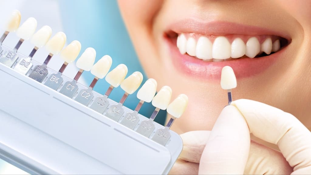 white spot denti - macchie denti - rimedi - dentista lecce - studio dentistico frassanito - monteroni di lecce