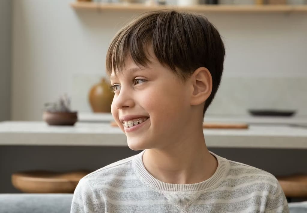 apparecchio denti bambini - studio dentistico frassanito - dentista lecce